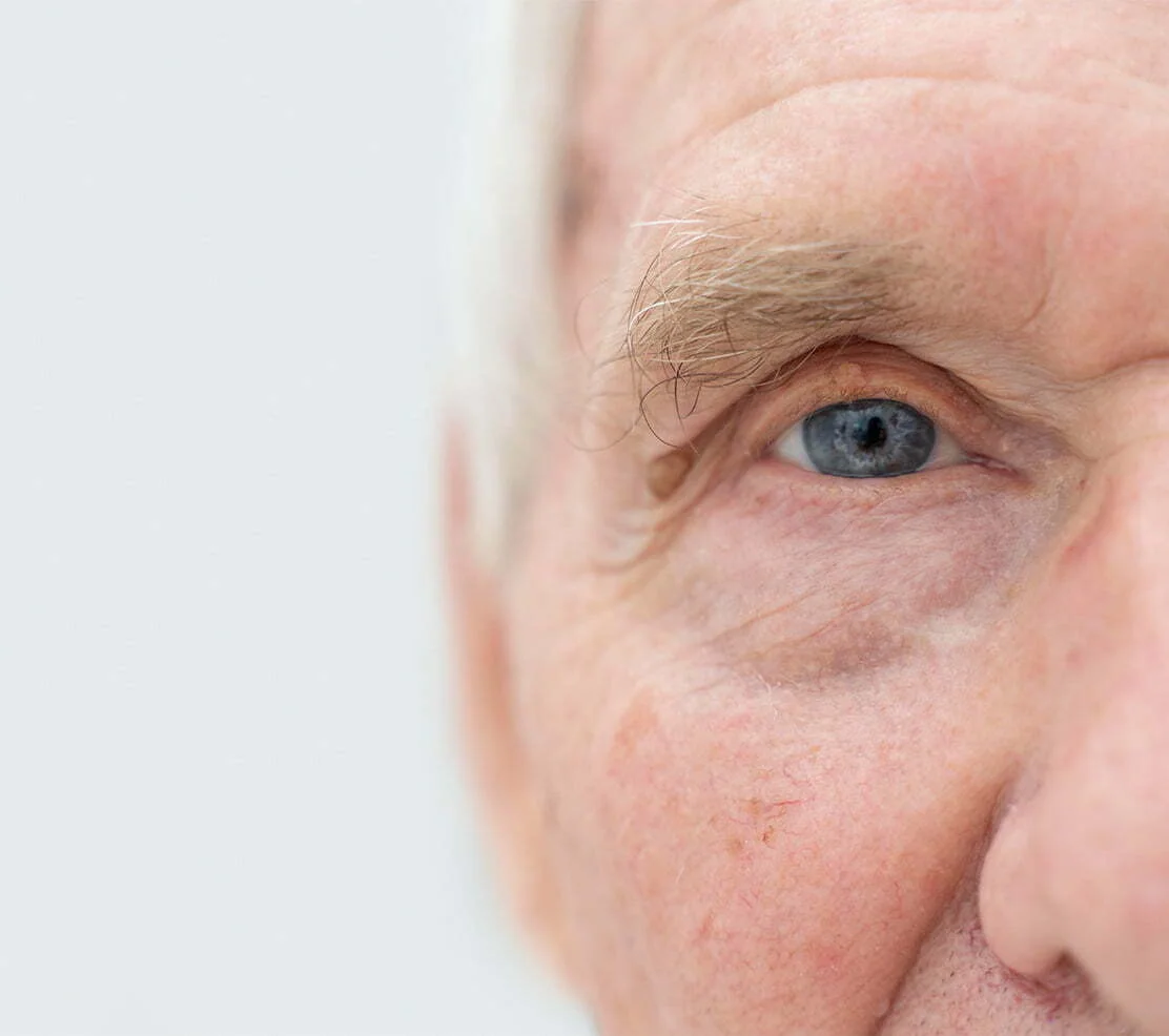 Cataract Surgery