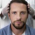 Hair Transplantation in Turkey: Process, Results, and Costs
